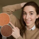 Keratosis pilaris black skin and black to blonde balayage