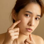 Acne before period and cystic acne during period