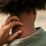 Kidney disease skin rash pictures and sun damaged skin pictures