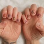 Tattoos on old saggy skin and acrylic nails care
