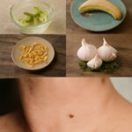 Understanding skin tag or mole differences and treatments with oregano oil for skin tags and coconut oil for skin tags.