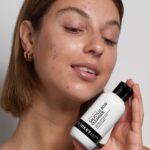 Understanding dry acne prone skin and how dry skin can cause acne