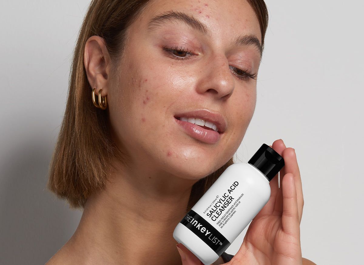 Understanding dry acne prone skin and how dry skin can cause acne