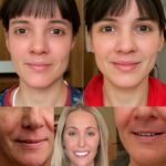 Skin consultation with a skin therapist at a skin day spa