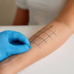 allergy skin test and allergy skin test results chart