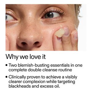 Skincare tips for dry skin acne and managing dry acne