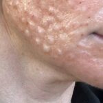 Is sperm good for skin and is semen good for the skin