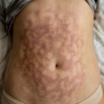 Mottled skin before death, skin color changes before death