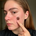 skin cancer on hand and eyelid differences