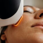 IPL for acne and detox for acne treatment