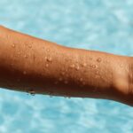 Effects of skin that smoke wagon and skin recovery after quitting smoking