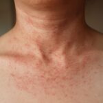 itchy skin causes and itching under the skin