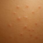 Chicken skin on arms and KP skin concerns