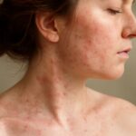 pictures of skin rashes, skin rashes images
